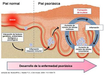 La homeopatía el tratamiento atopicheskogo de la dermatitis